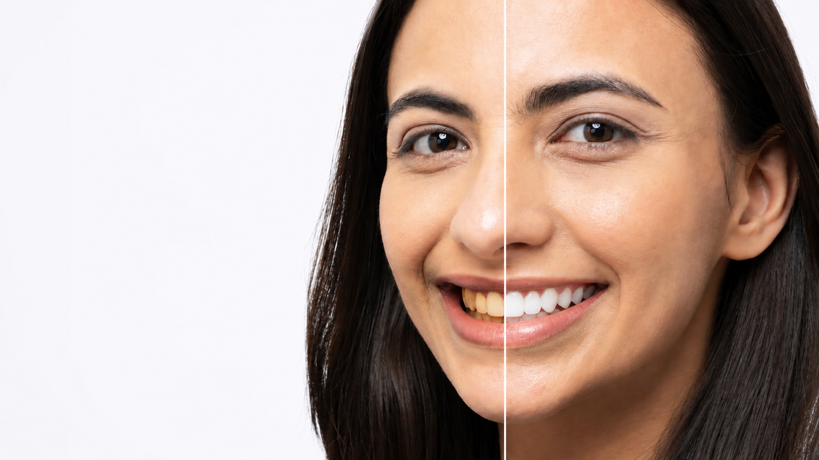 Teeth Cleaning & Whitening
